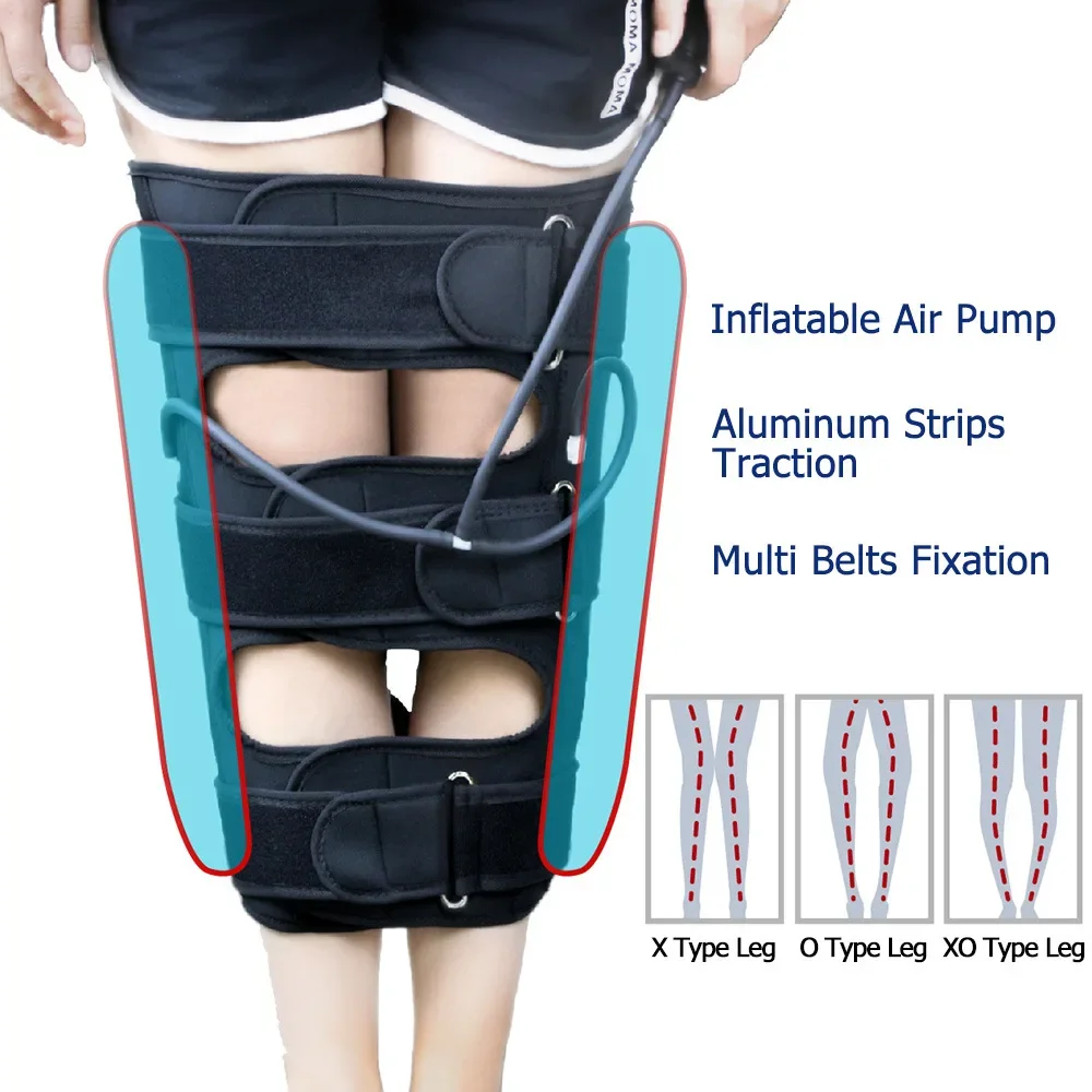 Pressure O/X Type Leg Posture Correction Strap Bent Leg Knee Valgus Straight Beauty Inflatable Leg Strap Adult Children Support
Pressure O/X Type Leg Posture Correction Strap Bent Leg Knee Valgus Straight Beauty Inflatable Leg Strap Adult Children Support