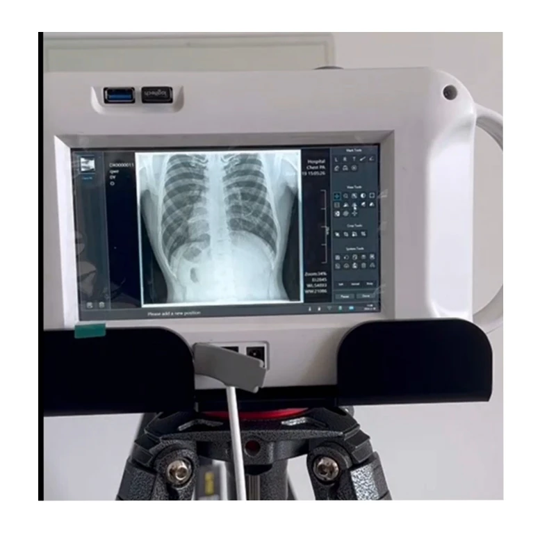 Medical Handheld X-Ray Machine Portable Vet X-Ray Radiography System Touch Screen Handheld X-ray Machine
Medical Handheld X-Ray Machine Portable Vet X-Ray Radiography System Touch Screen Handheld X-ray Machine