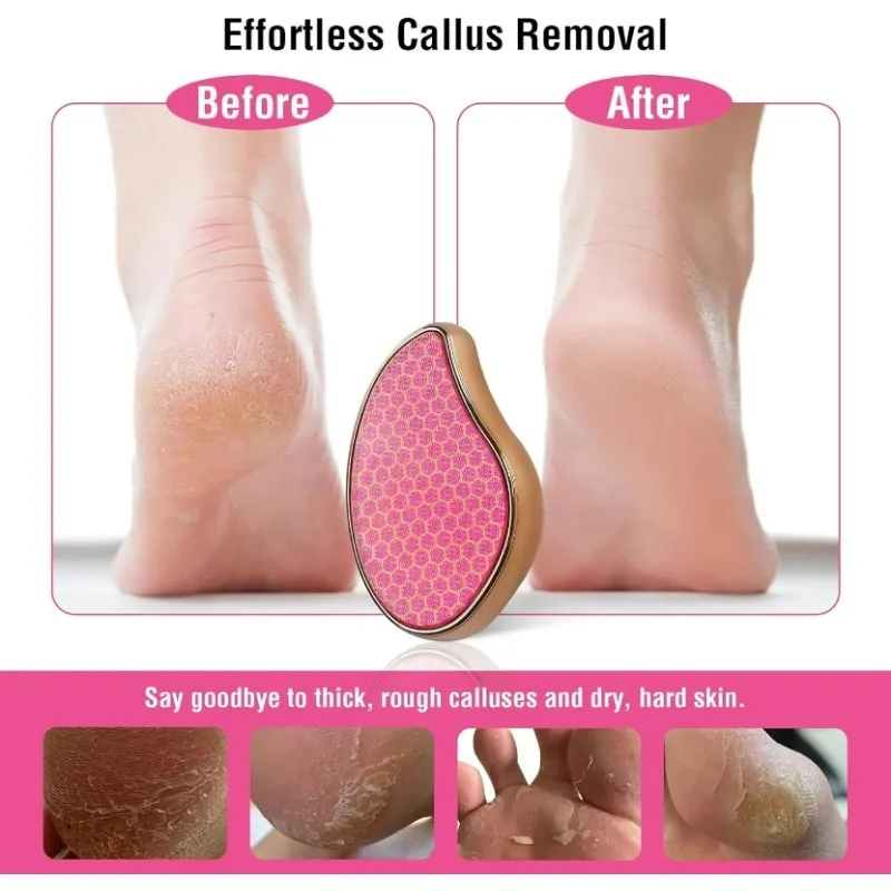 High Quality Nano Glass Heel Scraper Feet Shower Foot Scrubber Pedicure Dead Skin Remover Shower Care CrystalTreat Hair Tools
High Quality Nano Glass Heel Scraper Feet Shower Foot Scrubber Pedicure Dead Skin Remover Shower Care CrystalTreat Hair Tools
