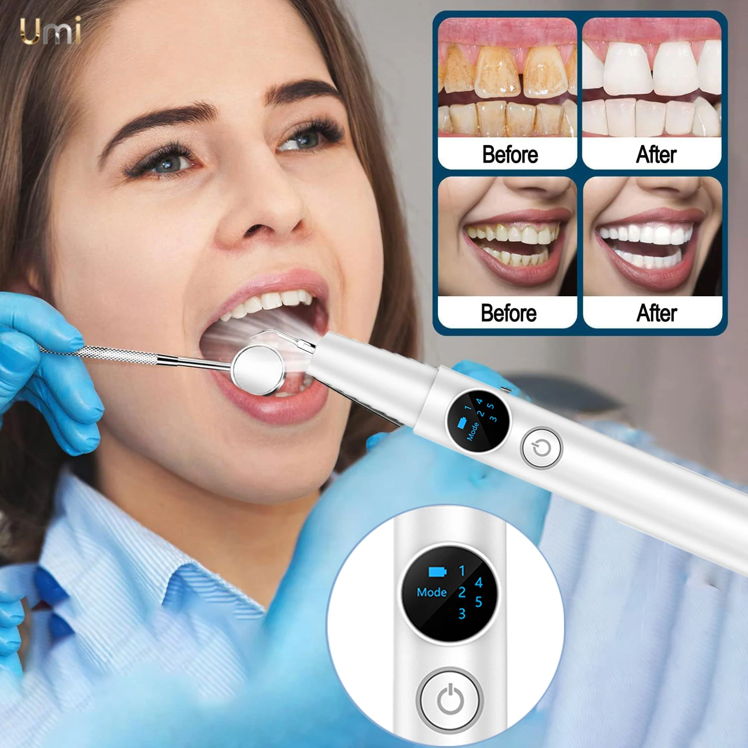 Dental Scaler for Teeth Tartar Remover with LED Light Rechargeable Hard Plaque Remover With 5 Mode Ultrasonic Teeth Cleaner Kit
Dental Scaler for Teeth Tartar Remover with LED Light Rechargeable Hard Plaque Remover With 5 Mode Ultrasonic Teeth Cleaner Kit