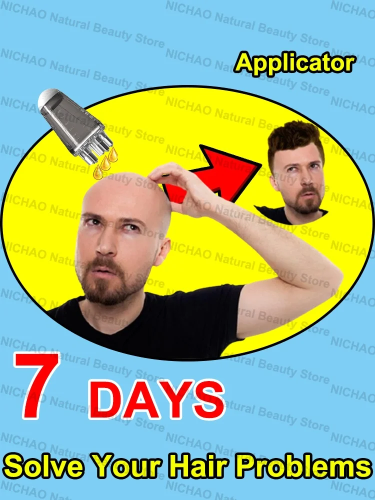 7 Days Fast Hair Growth Essential Loss Regrowth Treatment Strengthens Hair Nourishes Scalp Light Weight Non Greasy
7 Days Fast Hair Growth Essential Loss Regrowth Treatment Strengthens Hair Nourishes Scalp Light Weight Non Greasy