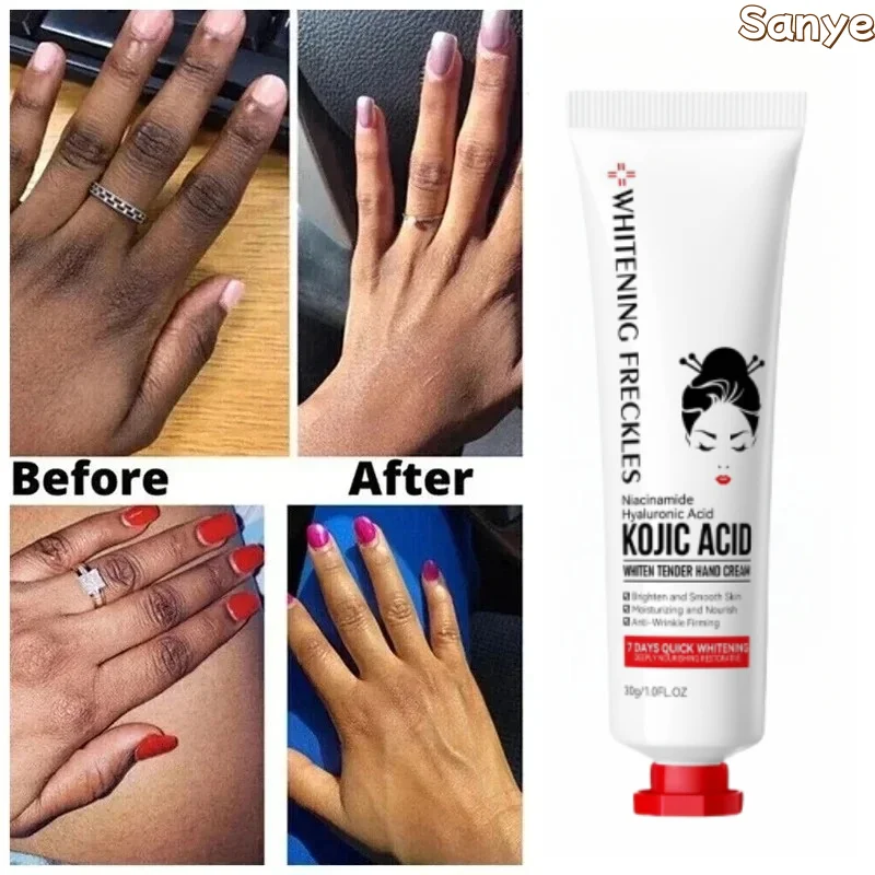 Kojic Acid Anti-wrinkle Hand Cream Moisturizing Anti-drying Be-whitening Finger Brightening Cream Dark Skin Corrector Skin Care
Kojic Acid Anti-wrinkle Hand Cream Moisturizing Anti-drying Be-whitening Finger Brightening Cream Dark Skin Corrector Skin Care