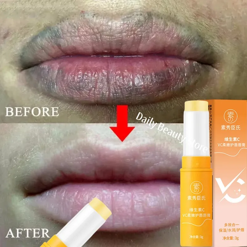 Remove Dark Lip Balm Lightening Melanin Mask Gloss Oil Exfoliating Clean Moisturizer Korean Care Products Makeup Beauty Health
Remove Dark Lip Balm Lightening Melanin Mask Gloss Oil Exfoliating Clean Moisturizer Korean Care Products Makeup Beauty Health