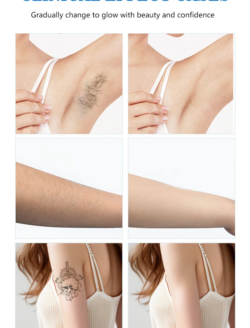 2 в 1 диодный лазер для удаления волос лед безболезненный александрит пикосекундный лазер для удаления татуировок многофункциональная система охлаждения
2 в 1 диодный лазер для удаления волос лед безболезненный александрит пикосекундный лазер для удаления татуировок многофункциональная система охлаждения