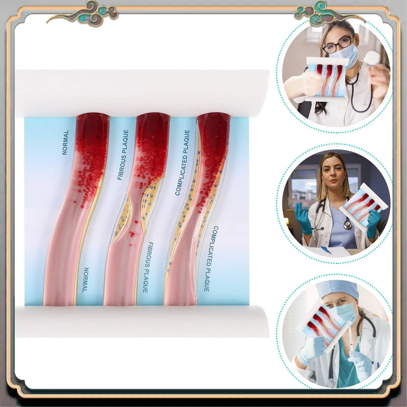 Durable Dynamic Blood Vessel Model Cardiovascular Blockage Contrast Model Thrombosis Model For Teaching Explanation
Durable Dynamic Blood Vessel Model Cardiovascular Blockage Contrast Model Thrombosis Model For Teaching Explanation