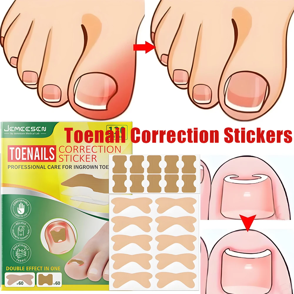 uñas Paronychia treatment patch, nail care, painless, for nail and foot repair, remove paronychia, Ingrown Toenail Care.
uñas Paronychia treatment patch, nail care, painless, for nail and foot repair, remove paronychia, Ingrown Toenail Care.