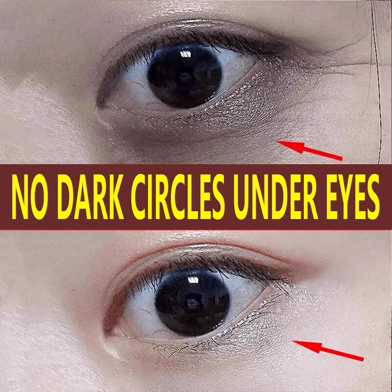60 pieces of cherry blossom eye mask moisturizes and reduces dark circles, removes dark spots, tightens and moisturizes
60 pieces of cherry blossom eye mask moisturizes and reduces dark circles, removes dark spots, tightens and moisturizes 