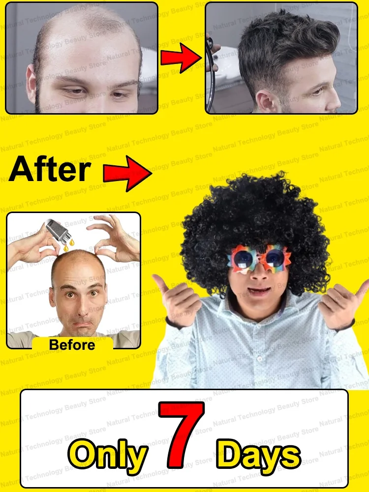 Аппликатор для кожи головы, аппликатор для меньшинств головы, раствор для роста волос, эфирное масло для массажа мяча, введение, расческа-покрытие
Аппликатор для кожи головы, аппликатор для меньшинств головы, раствор для роста волос, эфирное масло для массажа мяча, введение, расческа-покрытие