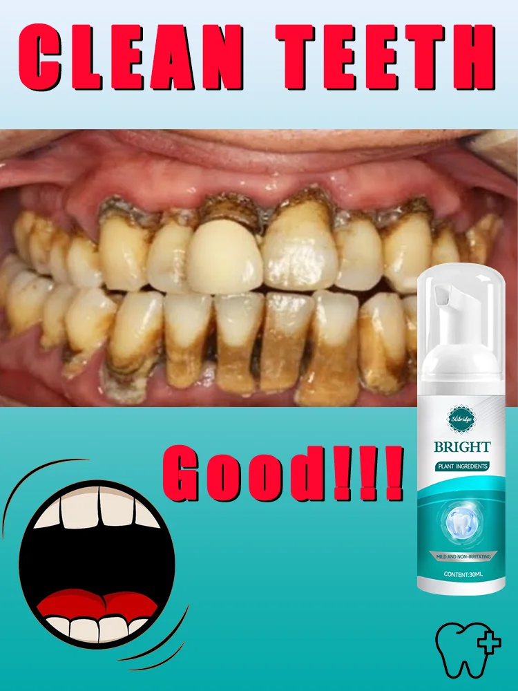 2025 Hotsale,Teeth cleaning care tools,quick clean,oral foam,Free shipping
2025 Hotsale,Teeth cleaning care tools,quick clean,oral foam,Free shipping