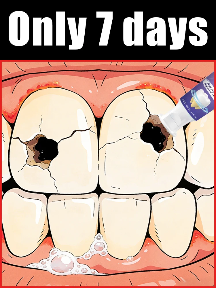 Tʜɪs ɴᴇᴡ ᴘʀᴏᴅᴜᴄᴛ ɢʀᴀᴅᴜᴀʟʟʏ ʀᴇᴘᴀɪʀs ᴄᴀᴠɪᴛɪᴇs ᴀɴᴅ ʀᴇᴍᴏᴠᴇs ᴅᴇɴᴛᴀʟ ᴘʟᴀᴏ̨ᴜᴇ.
Tʜɪs ɴᴇᴡ ᴘʀᴏᴅᴜᴄᴛ ɢʀᴀᴅᴜᴀʟʟʏ ʀᴇᴘᴀɪʀs ᴄᴀᴠɪᴛɪᴇs ᴀɴᴅ ʀᴇᴍᴏᴠᴇs ᴅᴇɴᴛᴀʟ ᴘʟᴀᴏ̨ᴜᴇ.