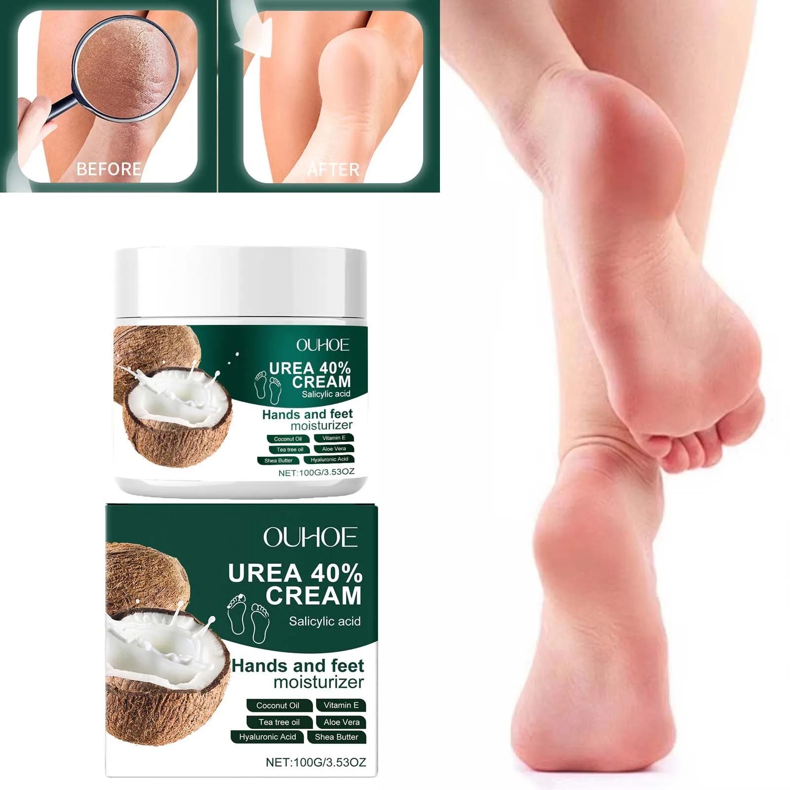 Urea 40% Cream Salicylic Acid Hand Foot Cream for Cracked Heels & Dry Skin Moisturizing Hydrating Callus Remover Smooth Skin
Urea 40% Cream Salicylic Acid Hand Foot Cream for Cracked Heels & Dry Skin Moisturizing Hydrating Callus Remover Smooth Skin