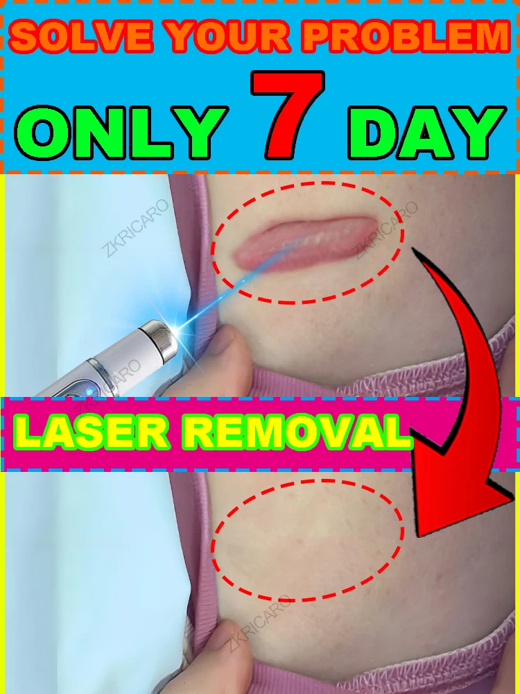 The latest laser technology, medical-grade laser, restores skin and eliminates troubles.
The latest laser technology, medical-grade laser, restores skin and eliminates troubles.