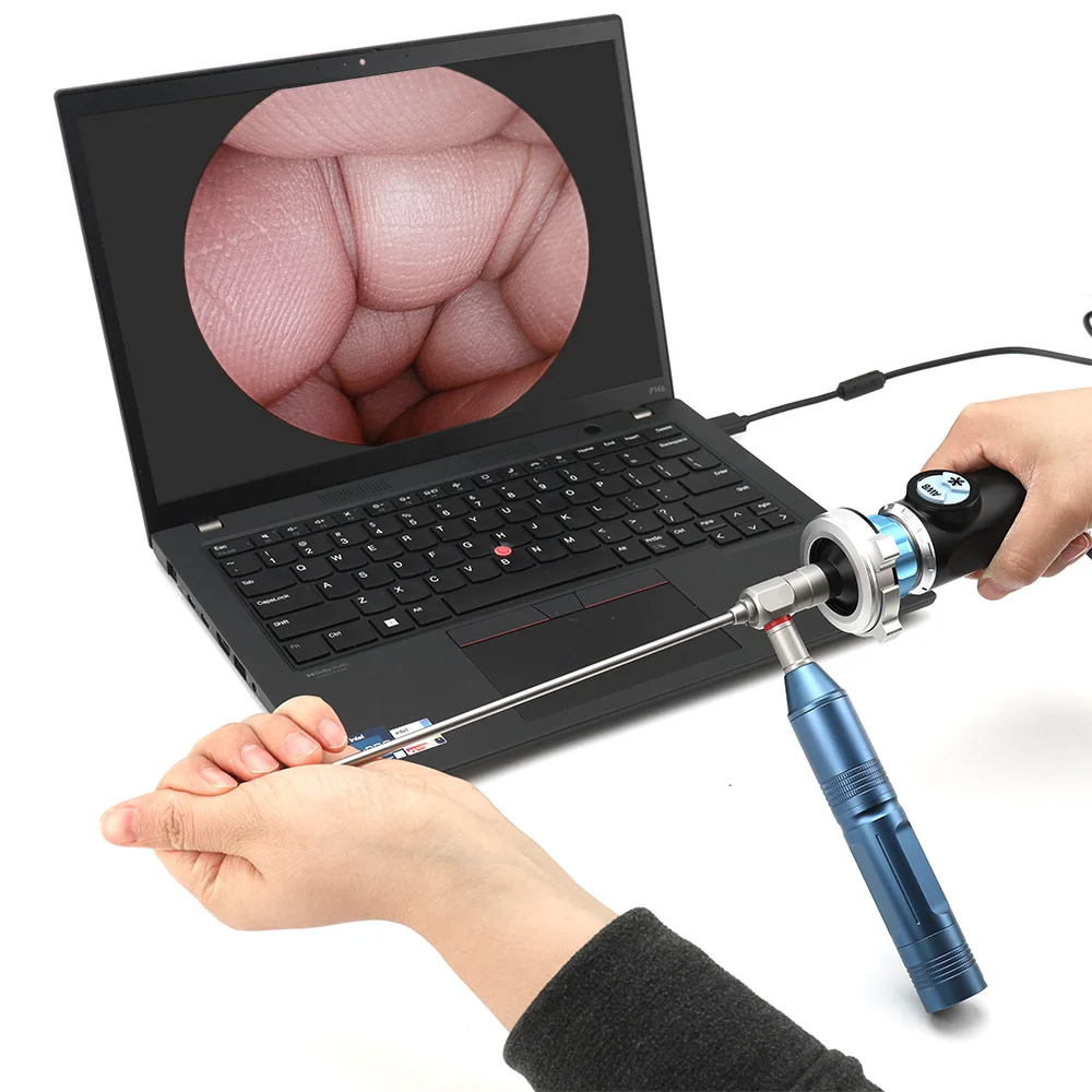 Medical Portable Full HD Rigid Endoscope USB Camera for ENT / Laparoscopy / Arthroscopy Easy Connect to Laptop
Medical Portable Full HD Rigid Endoscope USB Camera for ENT / Laparoscopy / Arthroscopy Easy Connect to Laptop