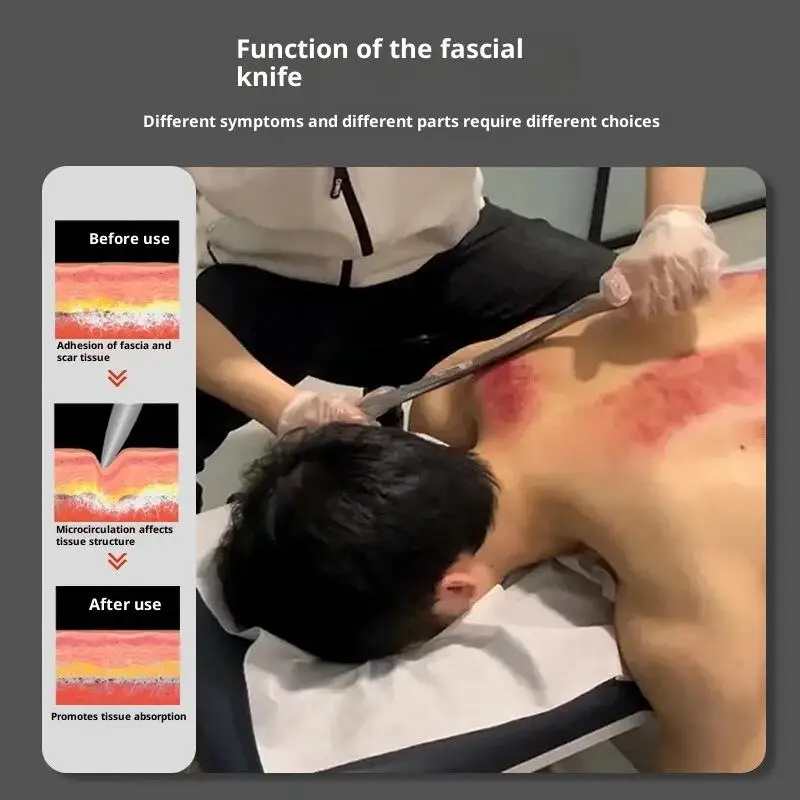 Стальной нож для гуаша-терапии – для мобилизации мягких тканей и больших мышц
Стальной нож для гуаша-терапии – для мобилизации мягких тканей и больших мышц