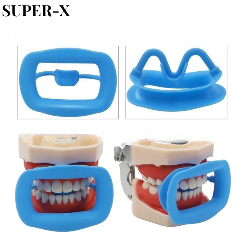 2PCS Dental Orthodontic Lip Cheek Retractor 3D Soft Silicone Mouth Opener Dentist Oral Care Dental Orthodontic Tools
2PCS Dental Orthodontic Lip Cheek Retractor 3D Soft Silicone Mouth Opener Dentist Oral Care Dental Orthodontic Tools