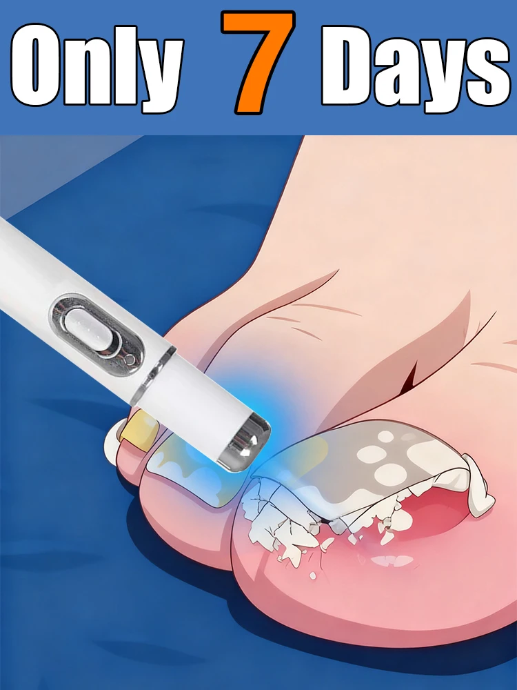 Модернизированный гвоздь 2-го поколения ремонт корня ногтей uickly
Модернизированный гвоздь 2-го поколения ремонт корня ногтей uickly