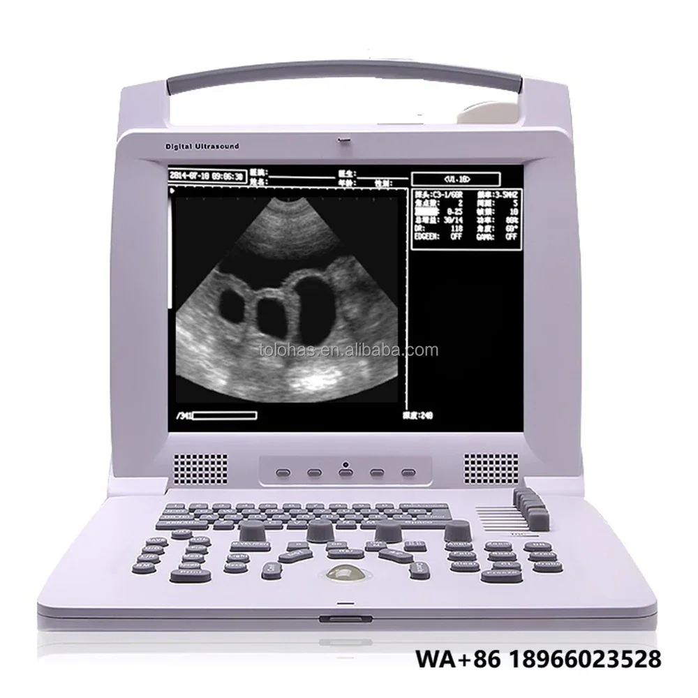LHWPL318VP Digital Ultrasound Notebook for Animals Veterinary Ultrasound Equipment Digital Ultrasound Animal
LHWPL318VP Digital Ultrasound Notebook for Animals Veterinary Ultrasound Equipment Digital Ultrasound Animal
