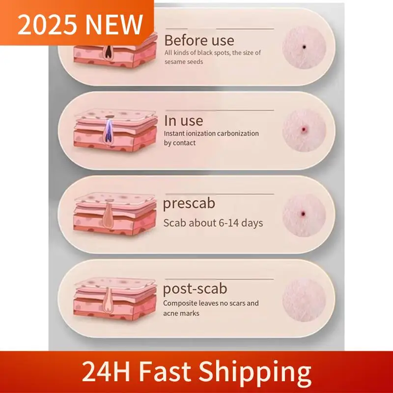 Mole Spotting Pen Laser Spotting Pen Beauty Instrument Painless Spotting Pen Silver Gray 1Set
Mole Spotting Pen Laser Spotting Pen Beauty Instrument Painless Spotting Pen Silver Gray 1Set