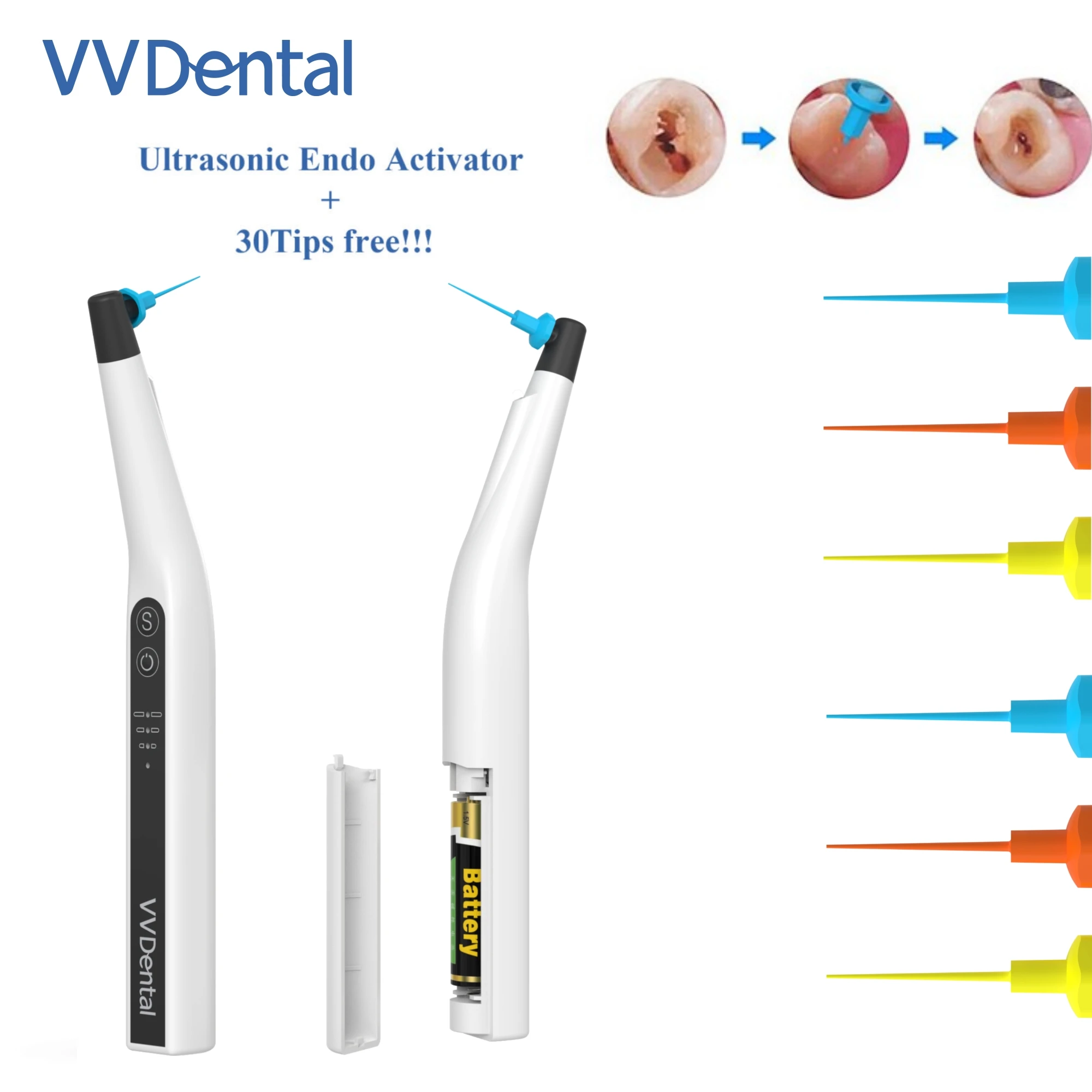VV Dental RW-3 Wireless Ultrasonic Activator Ultra-High Vibration Frequency ,With LED Light for Root Canal Filling Washing
VV Dental RW-3 Wireless Ultrasonic Activator Ultra-High Vibration Frequency ,With LED Light for Root Canal Filling Washing