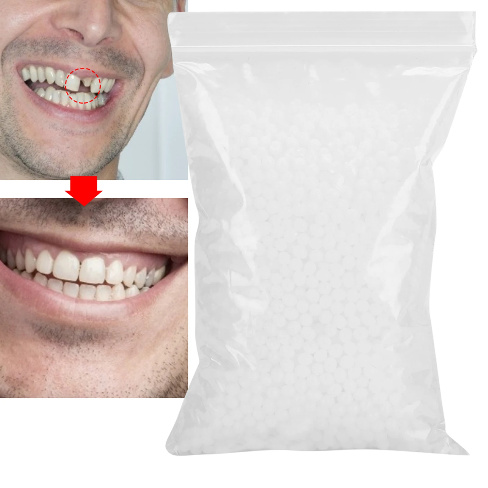 Temporary Tooth Repair Beads for Missing Broken Teeth Dental Tooth Filling Material Broken Teeth Repair Missing Teeth Repair
Temporary Tooth Repair Beads for Missing Broken Teeth Dental Tooth Filling Material Broken Teeth Repair Missing Teeth Repair