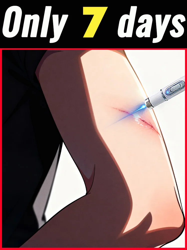 Модернизированный шрам 2-го поколения ремонт корней шрамов uickly
Модернизированный шрам 2-го поколения ремонт корней шрамов uickly