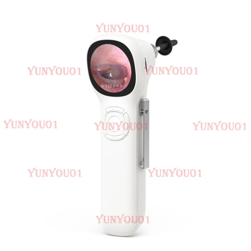 3.9Mm High Definition Ear Endoscope, Adult Children's Ear Artifact
3.9Mm High Definition Ear Endoscope, Adult Children's Ear Artifact