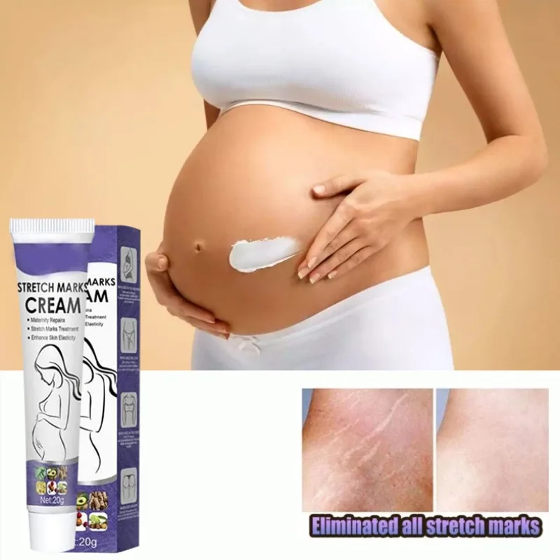 ᴴᴼᵀ Gentle Skin Care Improves Elasticity Effective After Pregnancy Stretch Marks Removal Powerful Maternity Cream Nourishes Skin 
ᴴᴼᵀ Gentle Skin Care Improves Elasticity Effective After Pregnancy Stretch Marks Removal Powerful Maternity Cream Nourishes Skin