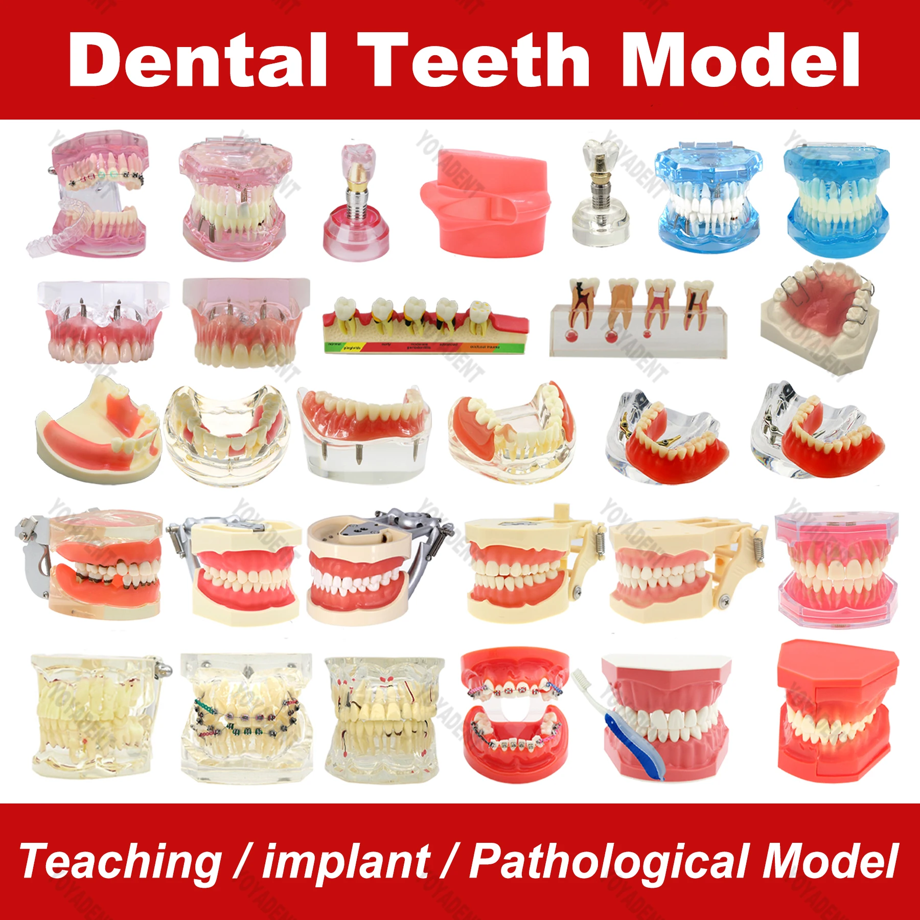 Multiple Types Dental Teeth Model Orthodontic Removable Teeth Implant Teeth Models For Patient Education Demo Dentist Material
Multiple Types Dental Teeth Model Orthodontic Removable Teeth Implant Teeth Models For Patient Education Demo Dentist Material