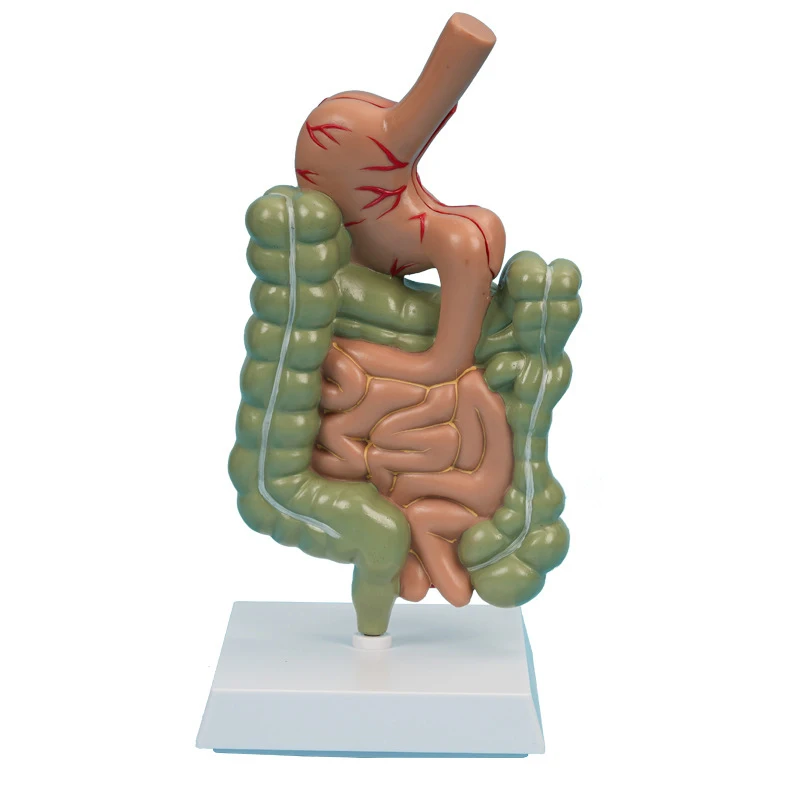 Large Intestine Lesion Pathological Diseases Model Human Stomach Anatomy Model Organs Model Human Body Model
Large Intestine Lesion Pathological Diseases Model Human Stomach Anatomy Model Organs Model Human Body Model