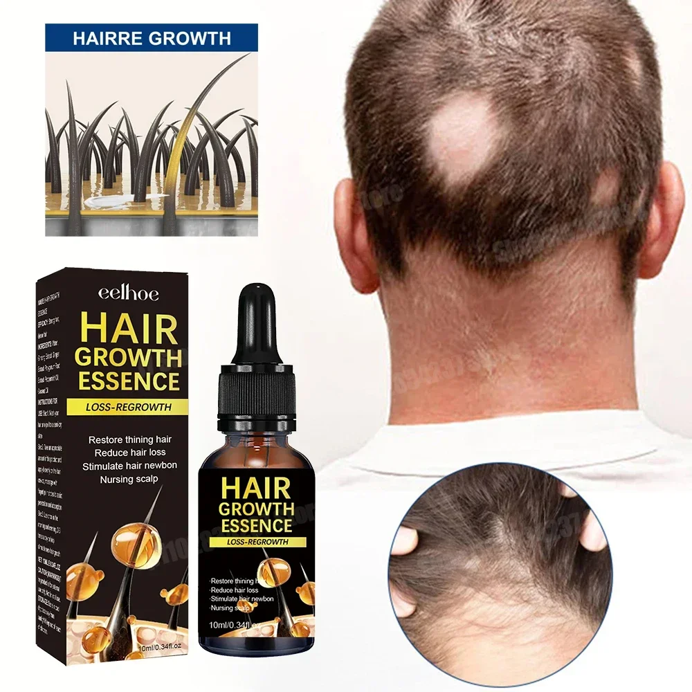 Hair Growth for Men Women Fast Growing Products Essential Oils Ginger Anti Hair Loss Scalp Hair Care 11 20
Hair Growth for Men Women Fast Growing Products Essential Oils Ginger Anti Hair Loss Scalp Hair Care 11 20