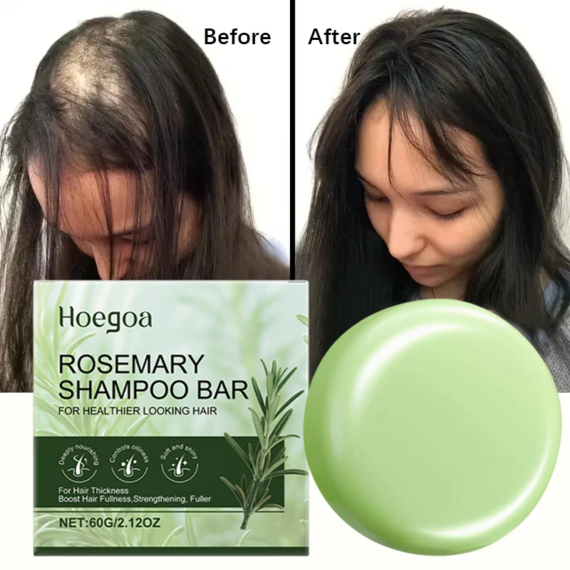 Мыло для роста волос с розмарином, лечение выпадения волос, мятное масло для укрепления волос, питательное средство для восстановления корней волос для мужчин и женщин, 60 г
Мыло для роста волос с розмарином, лечение выпадения волос, мятное масло для укрепления волос, питательное средство для восстановления корней волос для мужчин и женщин, 60 г