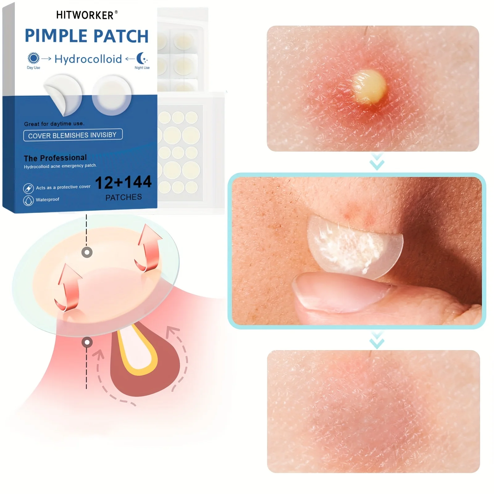 156PCS Hydrocolloid Pimple Patches - Beige Invisible Spot Covers, Day & Night Use, Gentle for All Skin, Sealed Hygienic Pack
156PCS Hydrocolloid Pimple Patches - Beige Invisible Spot Covers, Day & Night Use, Gentle for All Skin, Sealed Hygienic Pack