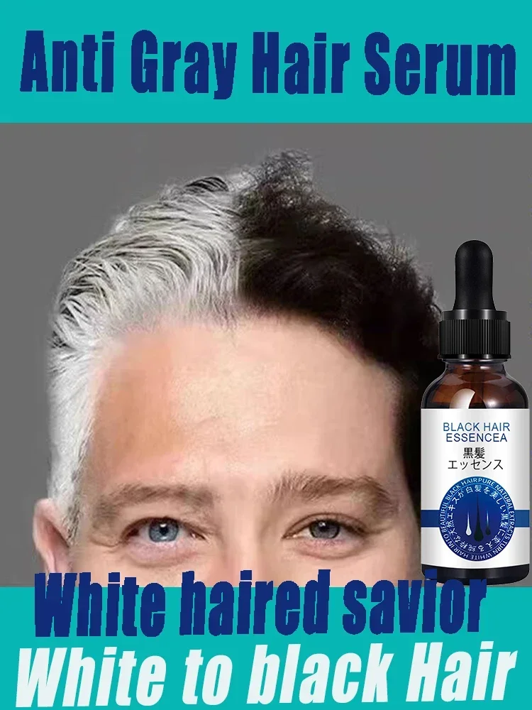 Anti Gray Hair Essence Blackening Serum Treatment White To Black Hair Repair Care Nourish Scalp
Anti Gray Hair Essence Blackening Serum Treatment White To Black Hair Repair Care Nourish Scalp