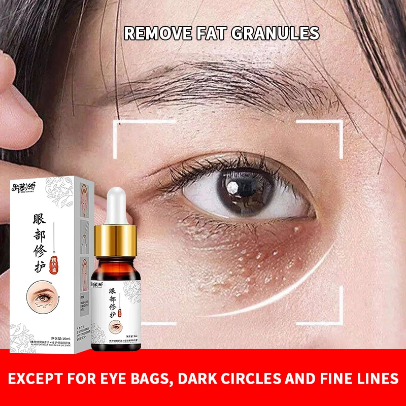 Eye Serum, Essential Oil, Fat Removal Granules, Men's and Women's Fine Line Removal, Anti-Wrinkle, Hydrating and Moisturizing
Eye Serum, Essential Oil, Fat Removal Granules, Men's and Women's Fine Line Removal, Anti-Wrinkle, Hydrating and Moisturizing