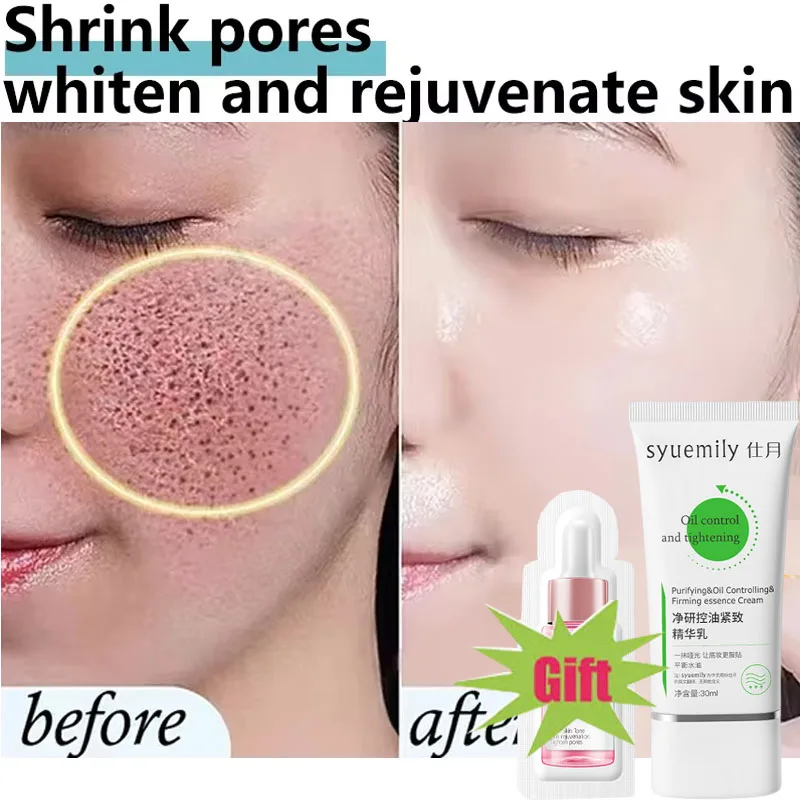 Salicylic Acid Shrink Pore Cream Elimination Large Pores Quick Remove Blackehead Tighten Face Smooth Repairing Skin Care Product
Salicylic Acid Shrink Pore Cream Elimination Large Pores Quick Remove Blackehead Tighten Face Smooth Repairing Skin Care Product