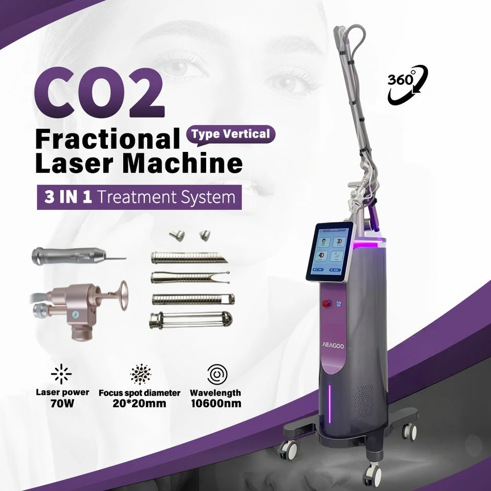 Медицинский класс 10600 нм CO2 лазер/эр машина фракционная машина CO2 удаление шрамов подтяжка кожи лечение прыщей
Медицинский класс 10600 нм CO2 лазер/эр машина фракционная машина CO2 удаление шрамов подтяжка кожи лечение прыщей