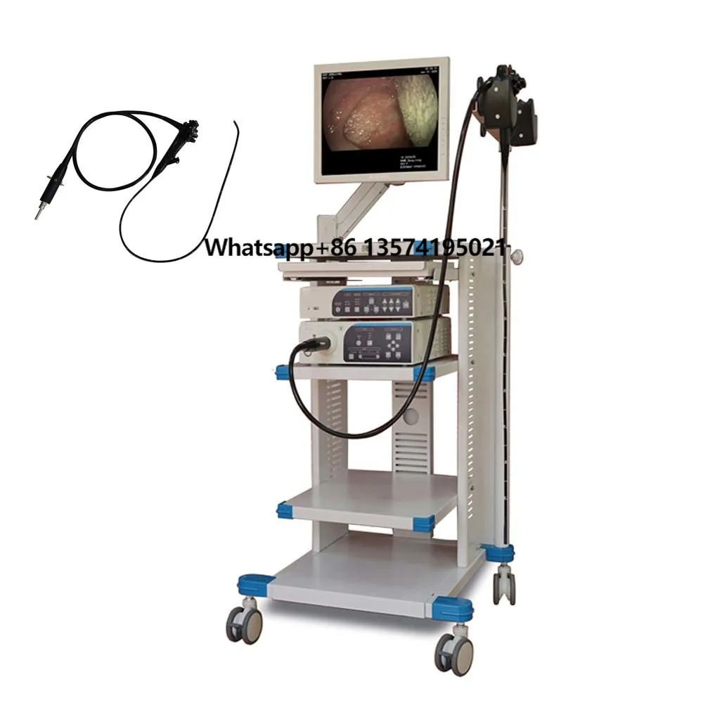 Gastroscopy Colonoscopy Hospital Medical Endoscope System Flexible Video Gastroscope and Colonoscope
Gastroscopy Colonoscopy Hospital Medical Endoscope System Flexible Video Gastroscope and Colonoscope