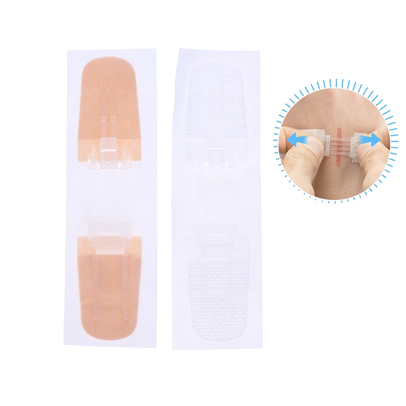 Безболезненная застежка на рану, пластырь на молнии, без швов, перевязочные пластыри, редуктор швов на молнии для удобного управления ранами
Безболезненная застежка на рану, пластырь на молнии, без швов, перевязочные пластыри, редуктор швов на молнии для удобного управления ранами