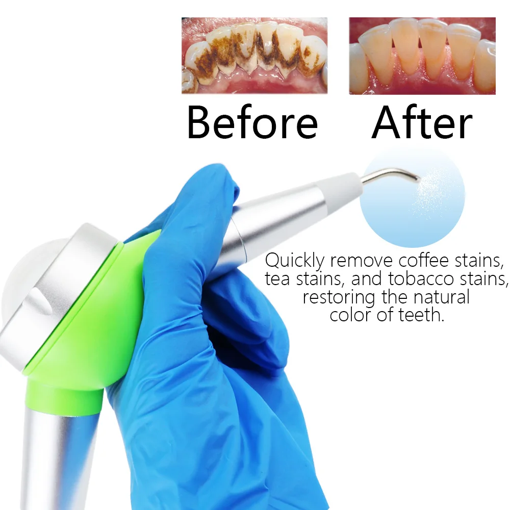 Стоматологический аппарат для воздушно-абразивной полировки Dental Prophy Jet Easy-jet, портативный полировщик с распылением воздуха и воды, 2/4 отверстия, ирригатор для полости рта, стоматологические инструменты
Стоматологический аппарат для воздушно-абразивной полировки Dental Prophy Jet Easy-jet, портативный полировщик с распылением воздуха и воды, 2/4 отверстия, ирригатор для полости рта, стоматологические инструменты