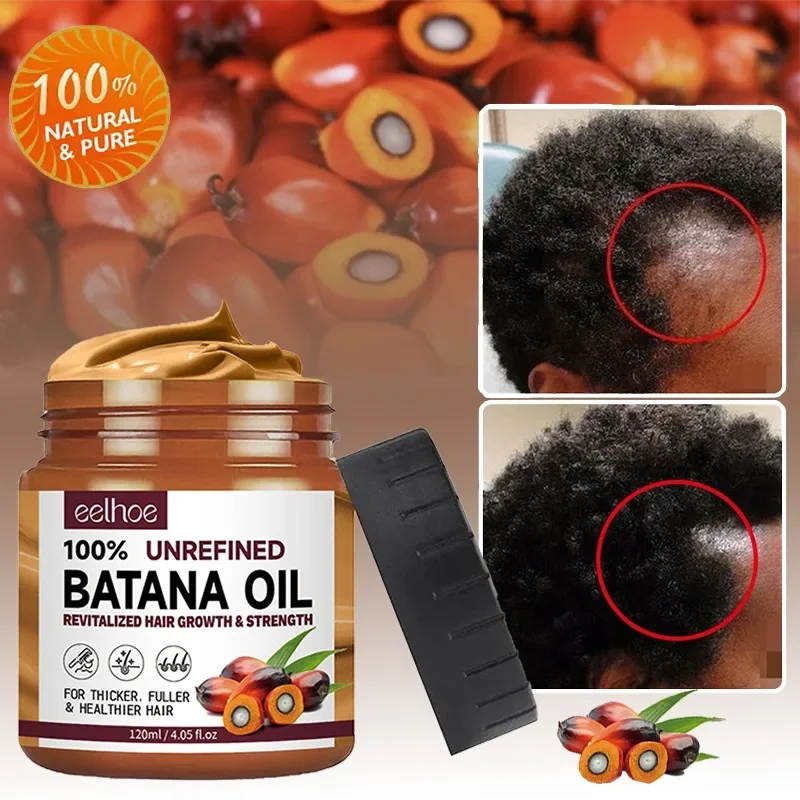Масляная маска для волос Batana, 100% натуральная Масляная маска против выпадения волос, против роста волос из Гондураса, лечение против выпадения волос для черных мужчин и женщин
Масляная маска для волос Batana, 100% натуральная Масляная маска против выпадения волос, против роста волос из Гондураса, лечение против выпадения волос для черных мужчин и женщин