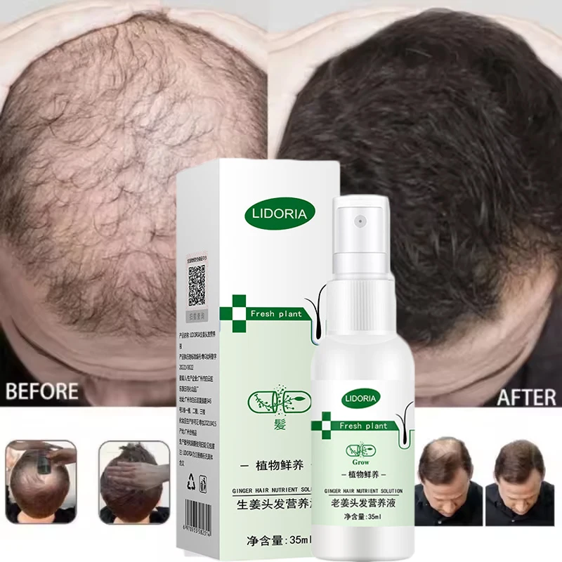 New Powerful Hair Growth Serum Spray Repair Hair Nourish Root Regrowth Hair Anti Hairs Loss Essence Men Women Hairs Care Product
New Powerful Hair Growth Serum Spray Repair Hair Nourish Root Regrowth Hair Anti Hairs Loss Essence Men Women Hairs Care Product