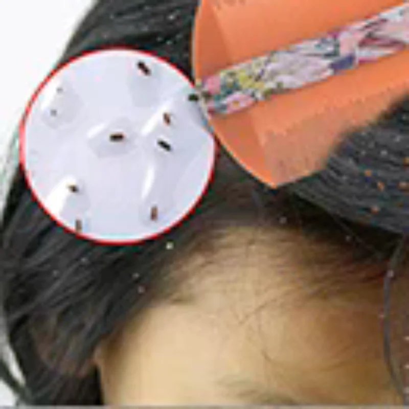 1Pc Styling Tools Lice Comb Encryption Grate Both Sides Dandruff Hair Care Brush
1Pc Styling Tools Lice Comb Encryption Grate Both Sides Dandruff Hair Care Brush