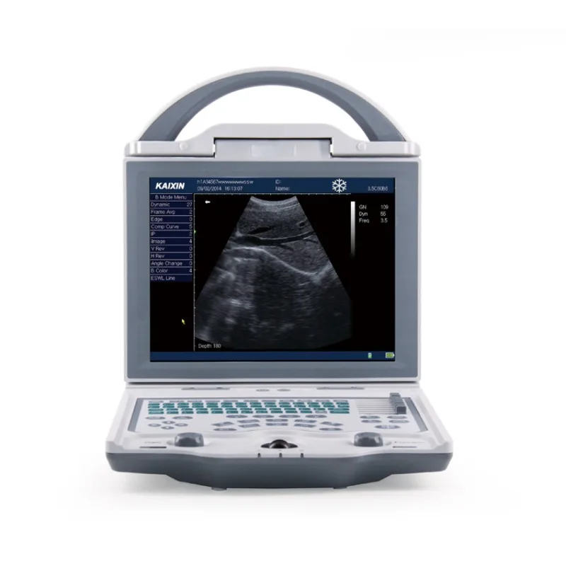Portable Veterinary Ultrasound Machine KX5600 Ultrasound Scanner Animal Care and Supplies
Portable Veterinary Ultrasound Machine KX5600 Ultrasound Scanner Animal Care and Supplies