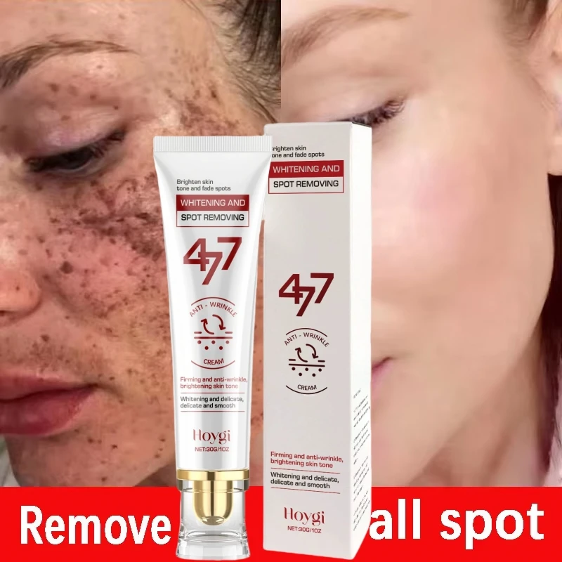 Мощный отбеливающий крем для удаления пятен, осветляющий кожу, быстрое устранение пигментации меланина, мелазма, темные пятна, корейский уход за кожей лица
Мощный отбеливающий крем для удаления пятен, осветляющий кожу, быстрое устранение пигментации меланина, мелазма, темные пятна, корейский уход за кожей лица