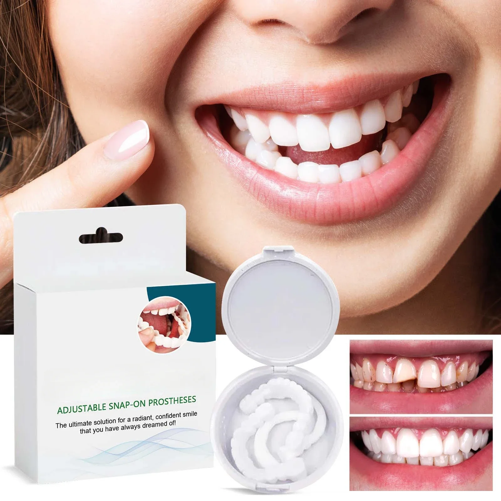 Adjustable snap-on dentures Cosmetic teeth interdental braces orthodontic denture kits for women and men
Adjustable snap-on dentures Cosmetic teeth interdental braces orthodontic denture kits for women and men