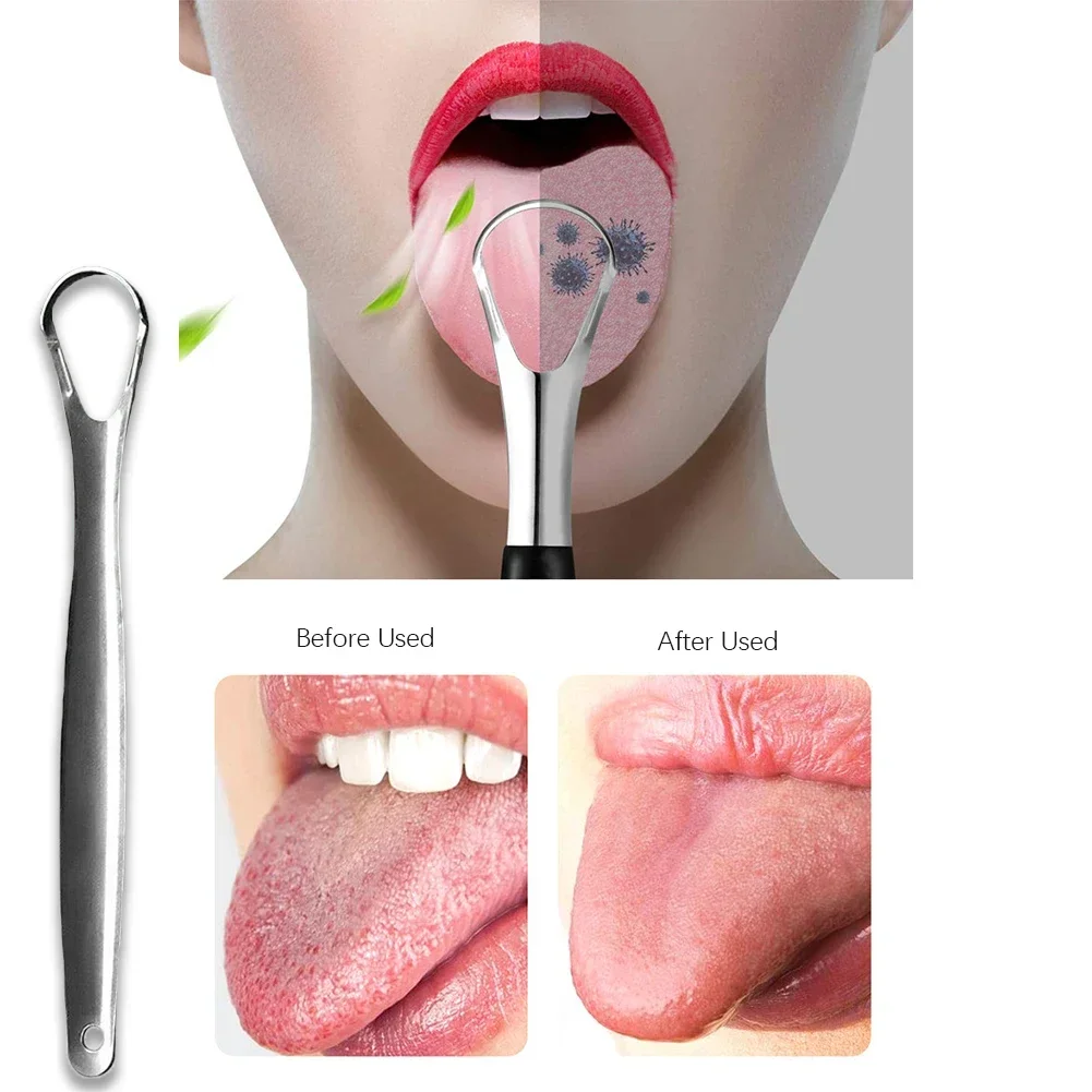 5Pcs Creative Tongue Scraper With Case Stainless Steel Oral Hygiene Care Mouth Coating Remover Clean Brush Adult Home Travel Use
5Pcs Creative Tongue Scraper With Case Stainless Steel Oral Hygiene Care Mouth Coating Remover Clean Brush Adult Home Travel Use