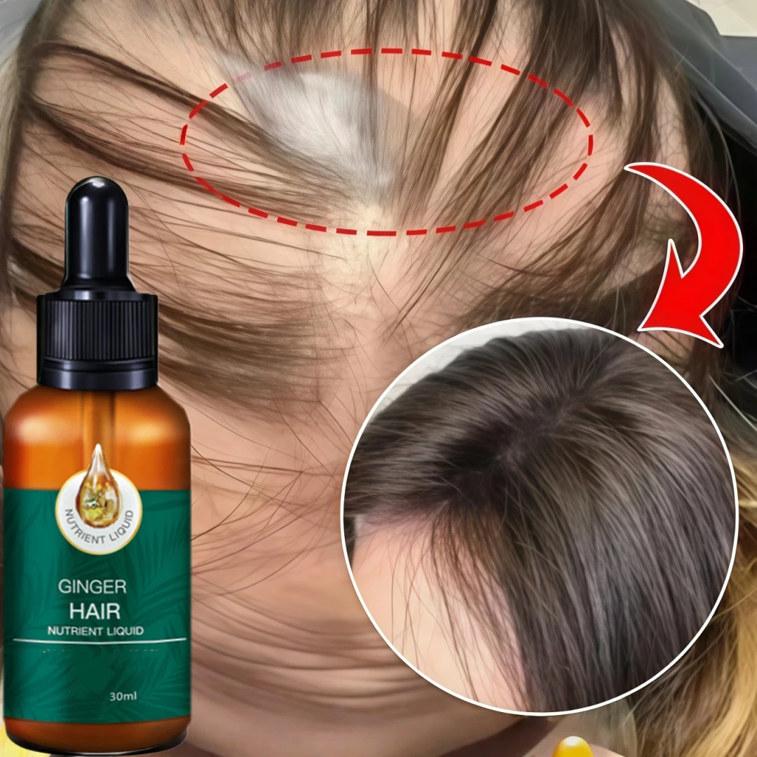 Имбирное масло для роста волос, сыворотка против выпадения волос, быстрый рост волос, предотвращение облысения, питание кожи головы, укрепление волос, продукты для роста волос
Имбирное масло для роста волос, сыворотка против выпадения волос, быстрый рост волос, предотвращение облысения, питание кожи головы, укрепление волос, продукты для роста волос