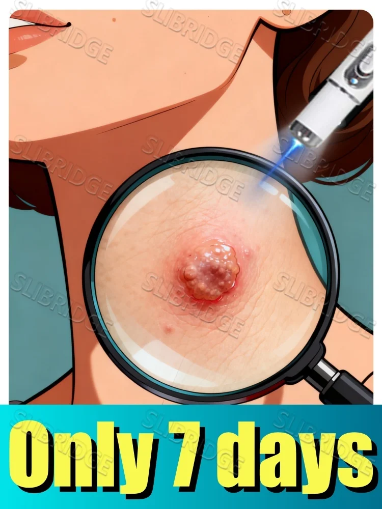 Portable tool mini wart blue light pen: multifunctional, preferred set
Portable tool mini wart blue light pen: multifunctional, preferred set