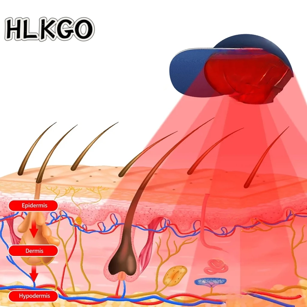Hot Sale Red Light Therapy Hat For Hair Growth 96 Diodes Fast Hair Regrowth Cap Ultra Strength Treatment Device
Hot Sale Red Light Therapy Hat For Hair Growth 96 Diodes Fast Hair Regrowth Cap Ultra Strength Treatment Device