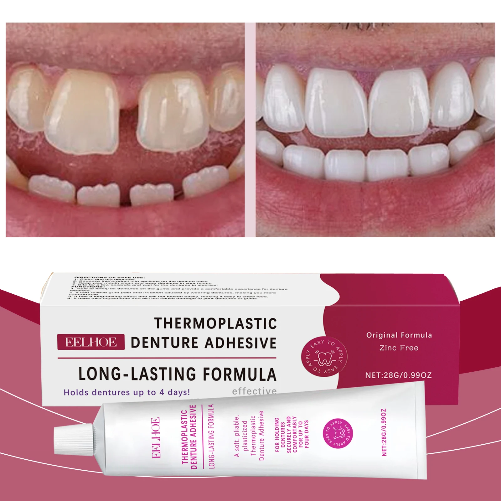 Seamless Fit Thermoplastic Denture Adhesive Fixed Dentures Long-lasting Reusable Care Comfortable And Portable Oral Health Care
Seamless Fit Thermoplastic Denture Adhesive Fixed Dentures Long-lasting Reusable Care Comfortable And Portable Oral Health Care